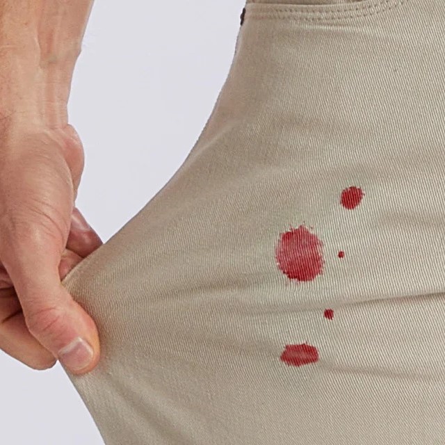 how to get ink out of jeans