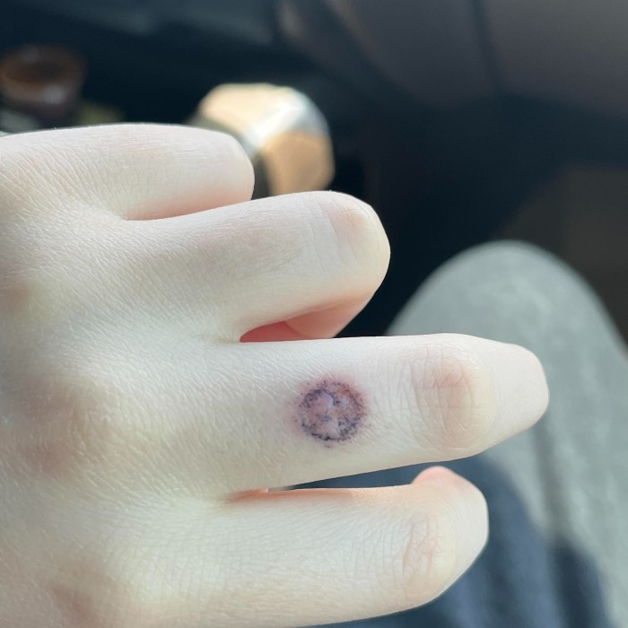 is pen ink toxic