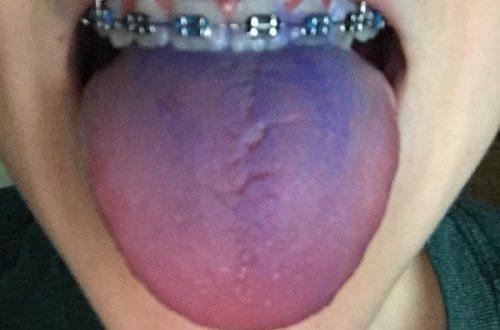 what happens if you eat ink from a pen