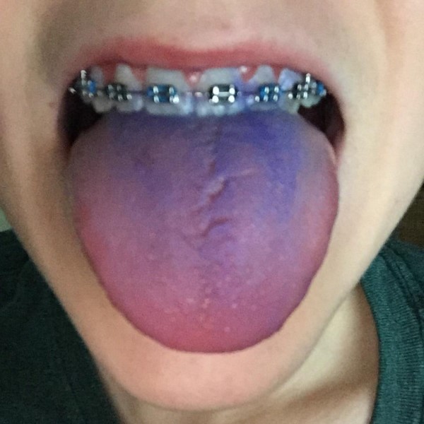 what happens if you eat ink from a pen